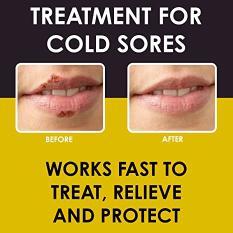 Cold sore lip deals treatment